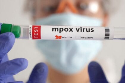 OMS convoca comitê para reavaliar emergência global por mpox